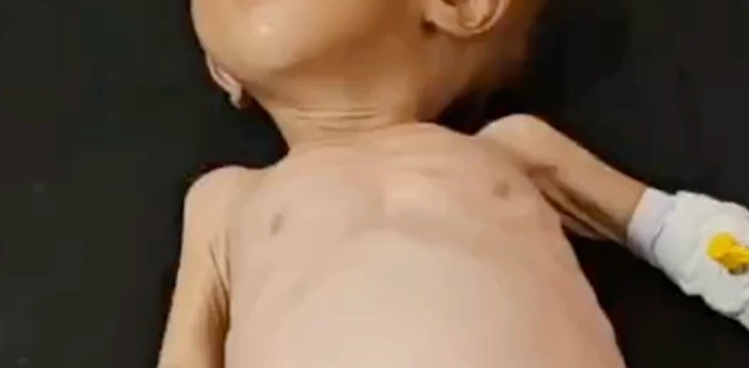 Dedeağaç’ta 3 yaşındaki çocuğun açlıktan ölümü: Anne tutuklandı!